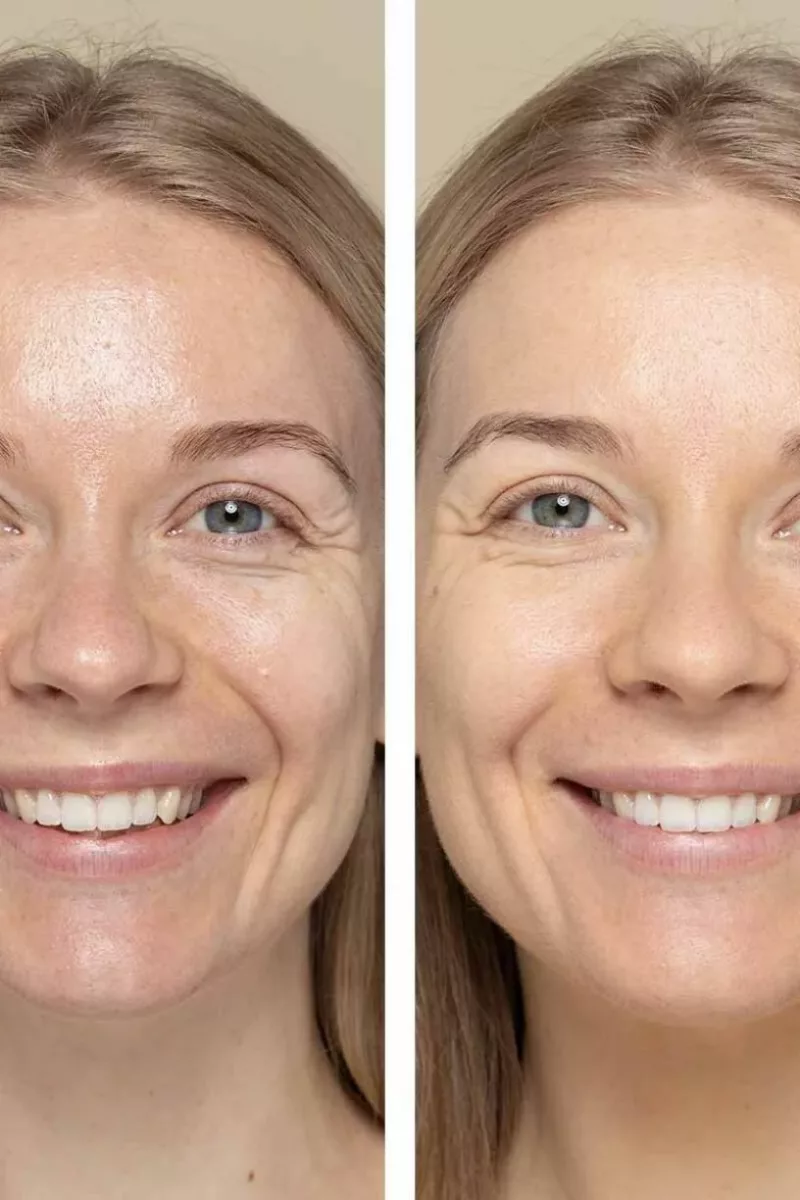 Foundation Powder 8g - Strawberry And Snow 636 - Uoga Uoga