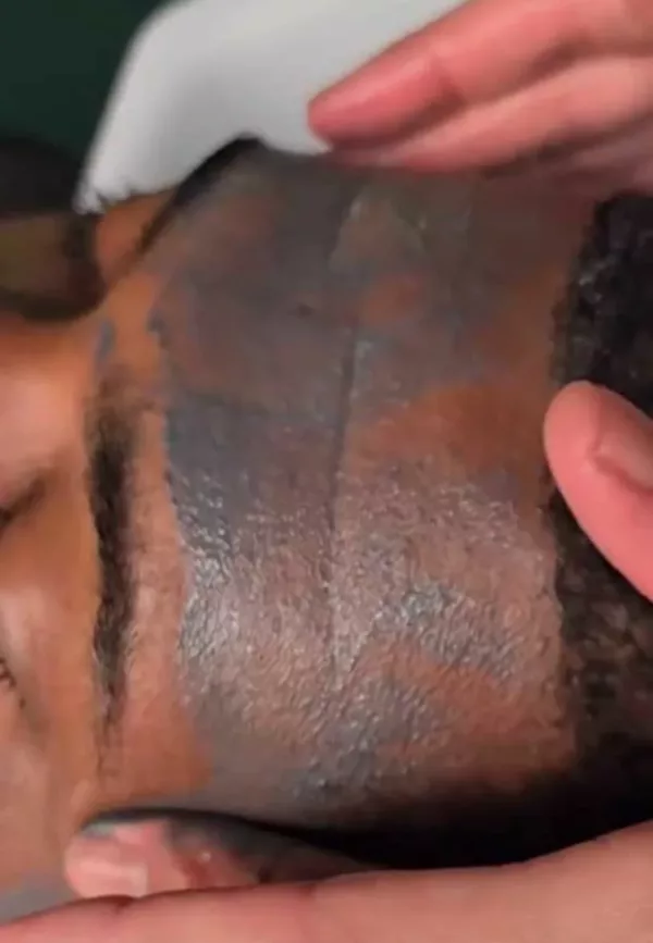 Masque exfoliant visage – Image 1