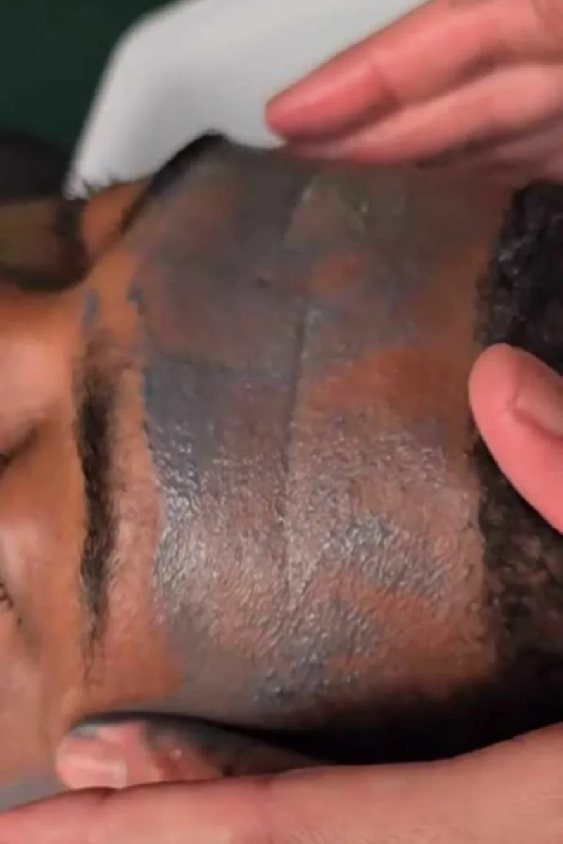 Masque exfoliant visage