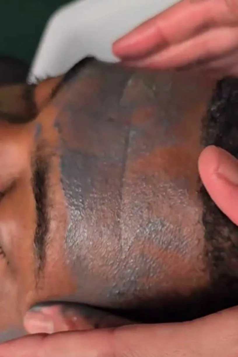 Masque exfoliant visage – Image 1