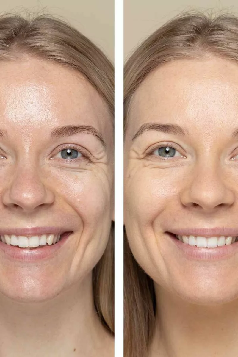 Foundation Powder 8g - Strawberry And Snow 636 - Uoga Uoga