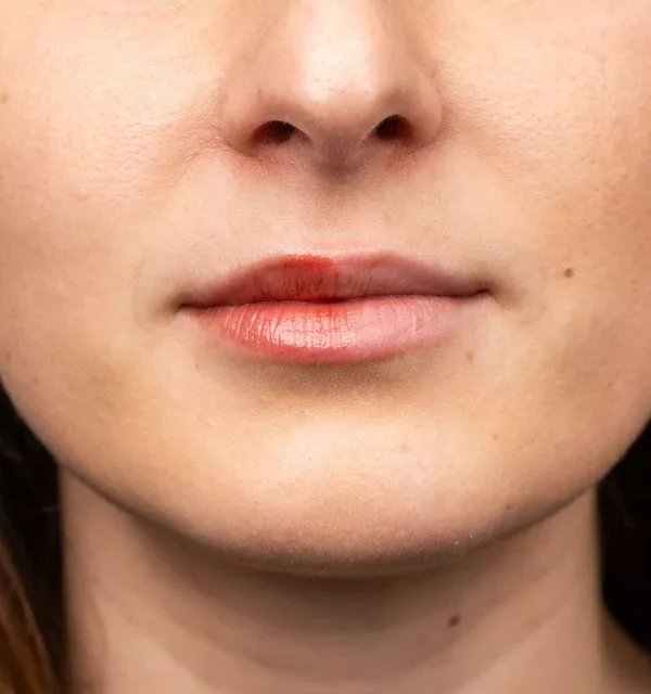 Baume à lèvres teinté - Framboise – Image 3