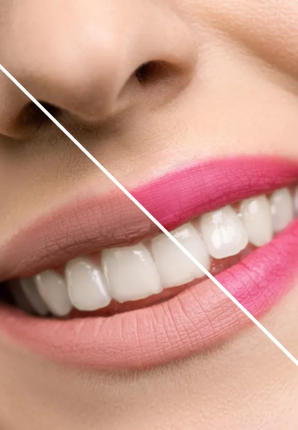 Flower In A Box - Fraise - Rose – Image 2