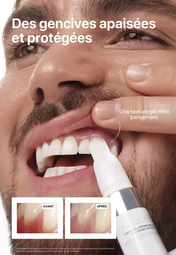 Sérum régénérant gencives – Image 3
