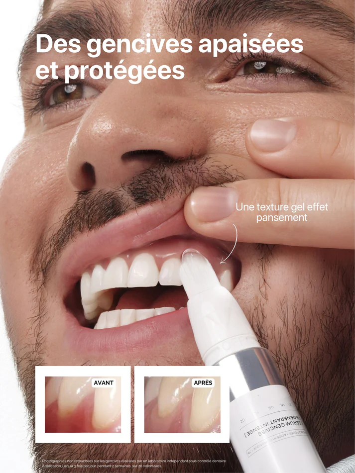 Sérum régénérant gencives