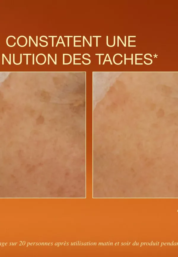 Sérum éclat - Anti-tâches – Image 3