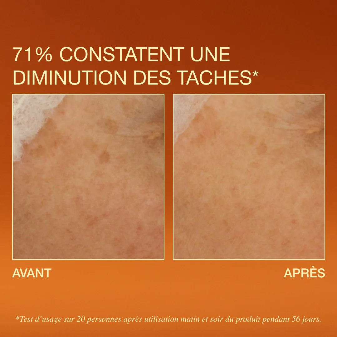 Sérum éclat - Anti-tâches – Image 3
