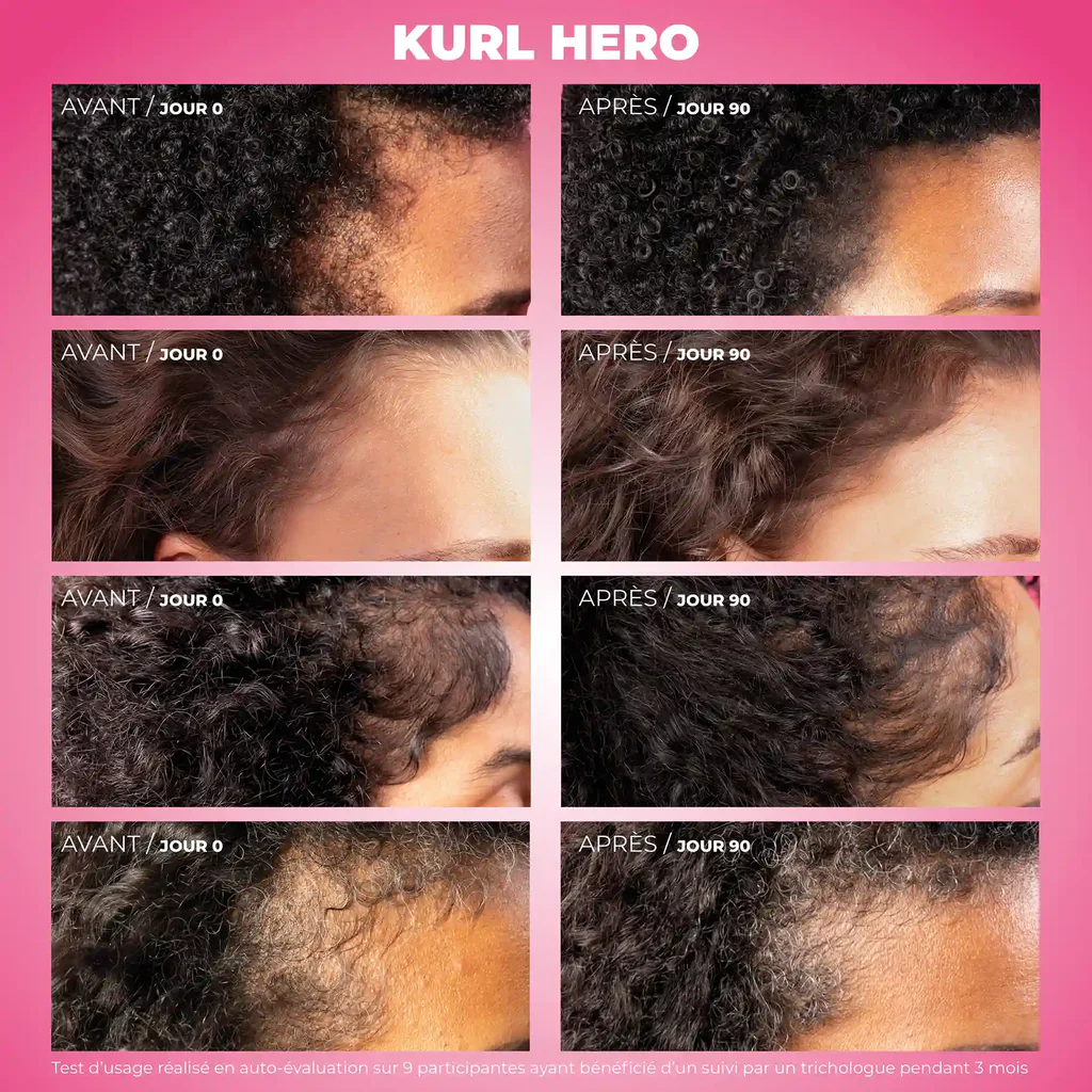 Kurl Hero - Sérum croissance – Image 3